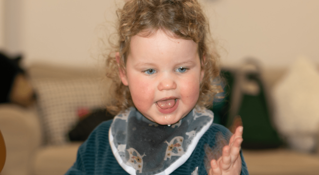 A young girl with Angelman's Syndrome.