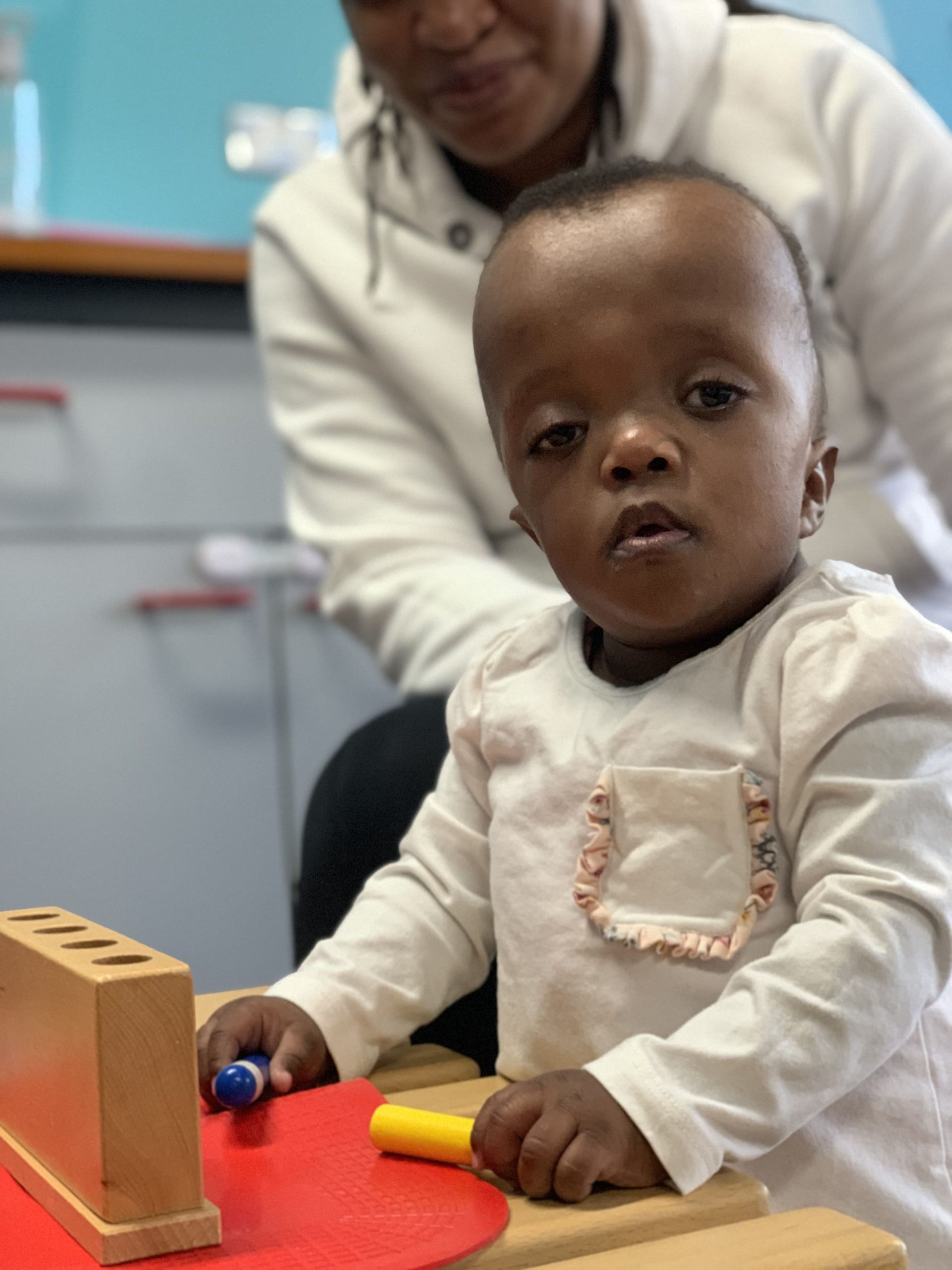 A young girl with Noonan's syndrome.