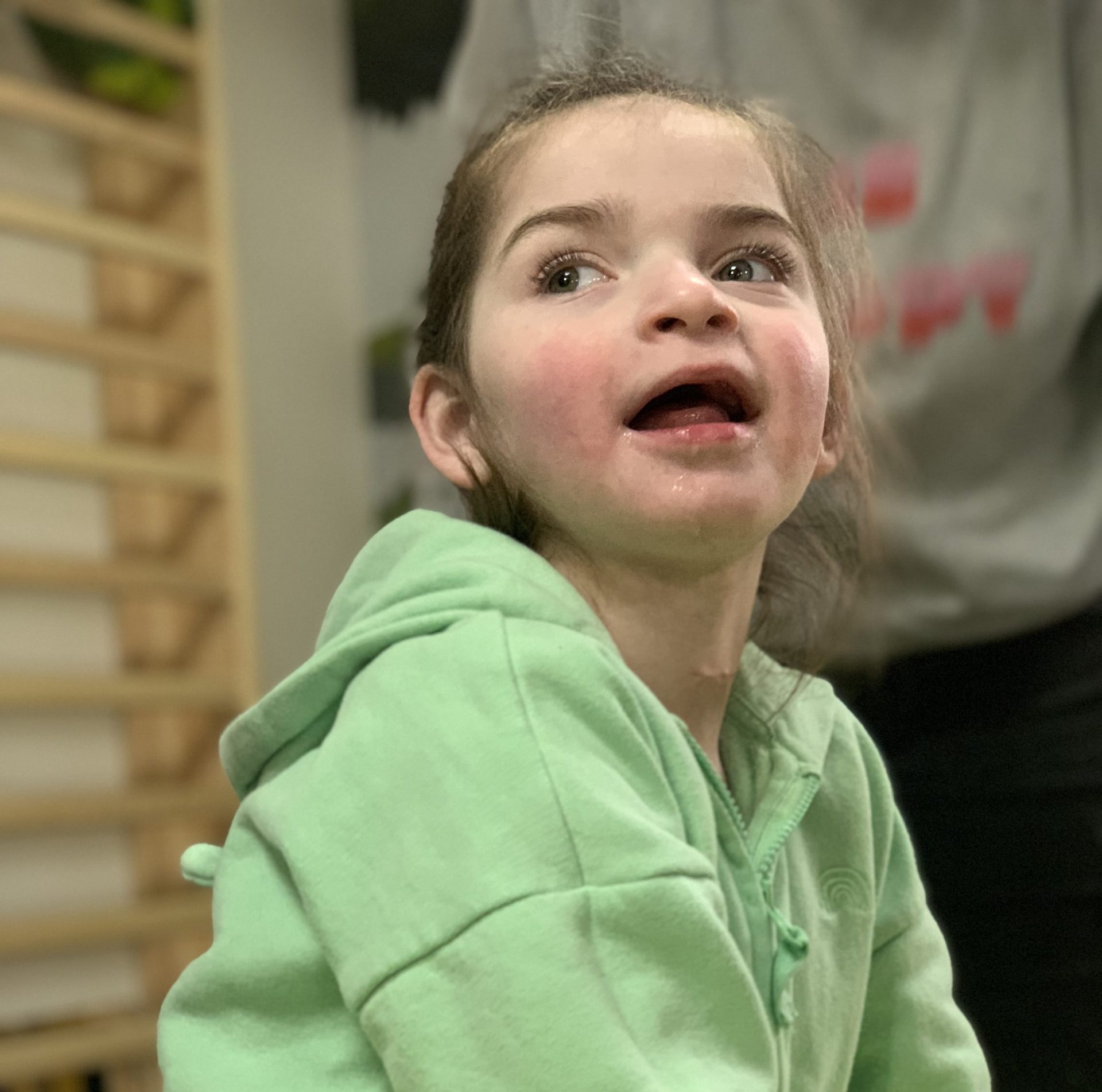 A young girl with Angelman's Syndrome.